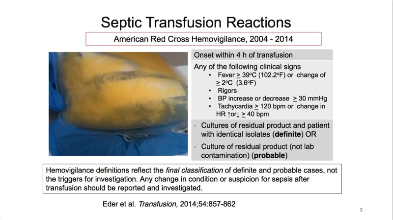 Slide Courtesy Dr. Anne Eder