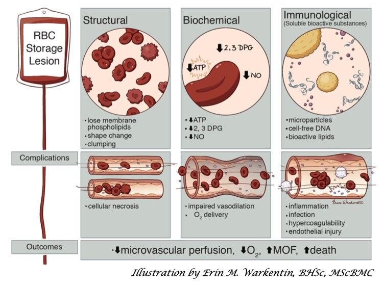 Heddle Slide 1: Blood Storage Lesion