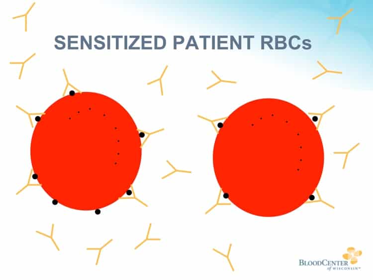 DAT procedure 1 - Fresh sample from patient to be tested